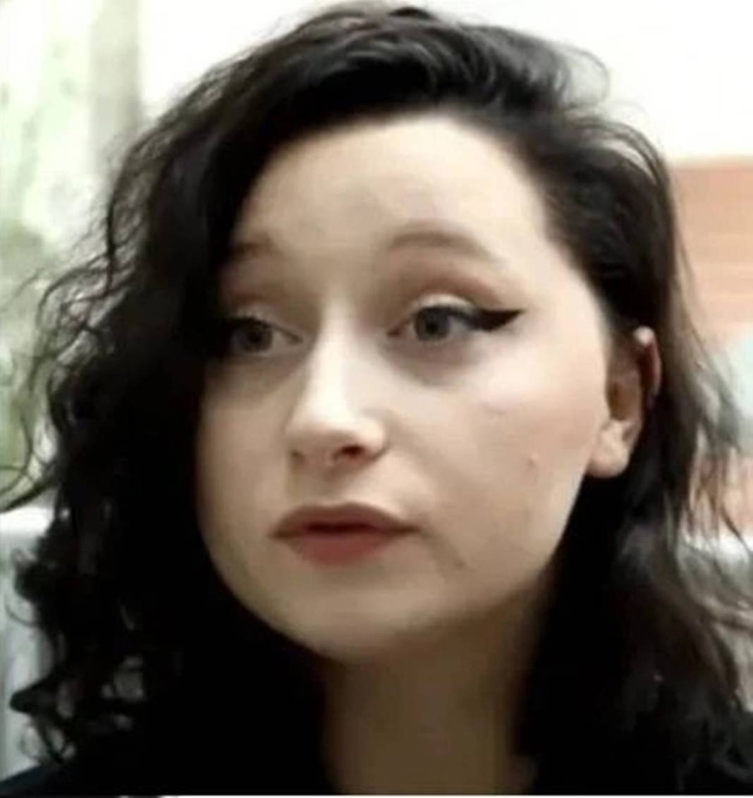 Marketten aldığı ürünle saçını boyadı: Kafası ampul gibi şişti! Yakınları bile tanıyamadı 9